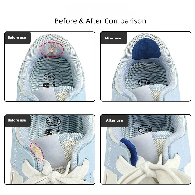 6 Buah Stiker Perbaikan Sepatu - Sneaker Care Service ulasan dan harga
